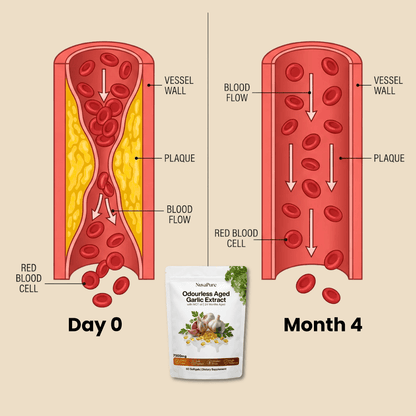 24-Month Aged Garlic Extract | Heart & Cholesterol Support Softgels